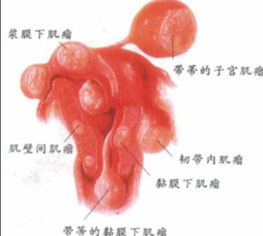 ӹ